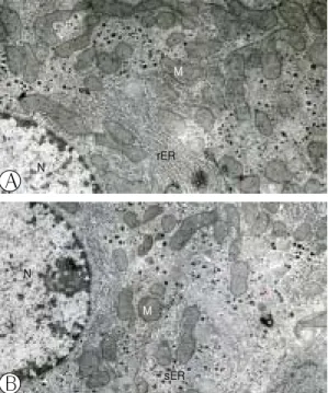 Fig. 12. Electron micrographs of hepatocytes from  TE4 group(A) and  SP3 group(B). In the  TE4 and SP3 group.