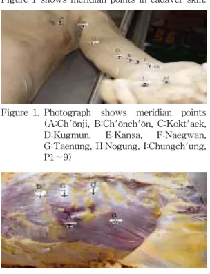 Figure  1  shows  meridian  points  in  cadaver  skin.