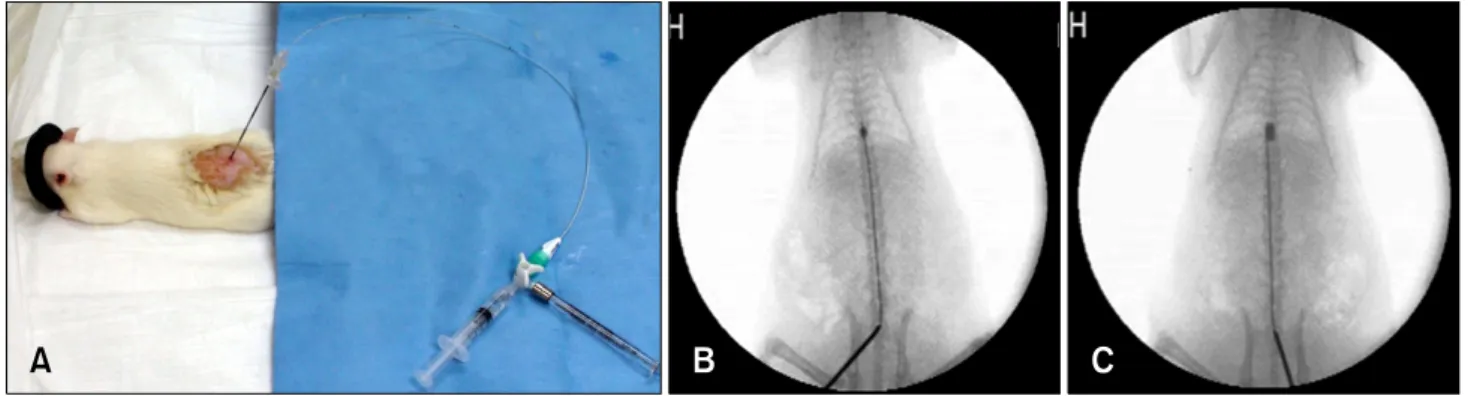 Fig. 1. Details regarding the SCI procedure. (A) A spinal needle was placed between the lumbosacral junction and a balloon catheter was inserted into the epidural space through a spinal needle