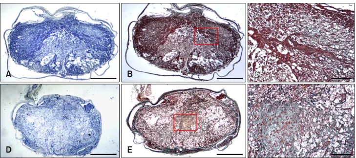Fig. 4. Observations from the 50 μL group of rats. (A) Transversal section of the margin of the lesion of the 50 μL group stained with H&amp;E revealing cavitation and glial scar formation of the dorsal  funiculus