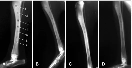 Fig. 2. Radiological evaluation on the 14th (A), 28th (B), 42nd (C) and 58th (D) postoperative days