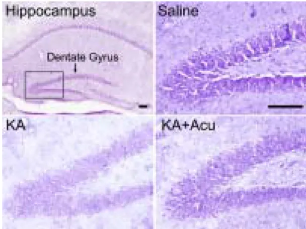 Fig. 2. The effects of acupuncture on kainic acid (KA)-induced cell death of the dentate gyrus in  the hippocampus  The  neuronal  destructions  were  observed  in  the  dentate  gyrus  of  KA-injected  group  (KA)