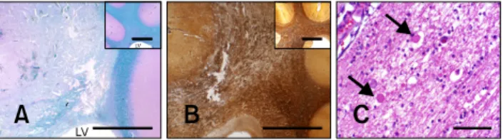 Fig. 6. Vascular sparing effects of N-TIRE. (A) A medium sized  arteriole (*) at the periphery of the N-TIRE ablation region  remained intact despite diffuse damage to the surrounding  neuropil in Dog 3 (H&amp;E)