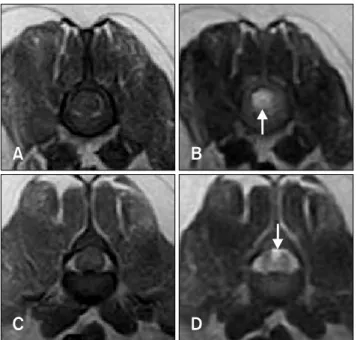 Fig. 1. T1-weighted (TR 530, TE 26) and T2-weighted (TR 3500, TE 90) MRI images of the dog 12 h (A∼D) after the onset of  clinical signs