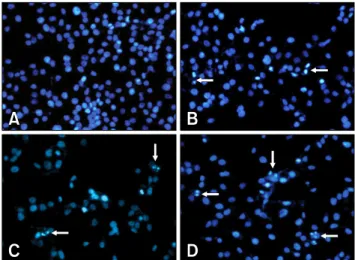 Fig. 2. The fluorescence microscopic morphology of HepG2  cells treated with BEE. Note the enhanced DNA fragmentations and apoptotic body (arrows) formations in cells treated with  200 μg/mL of BEE