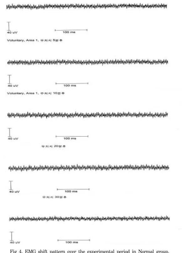 Fig  4.  EMG  shift  pattern  over  the  experimental  period  in  Normal  group.