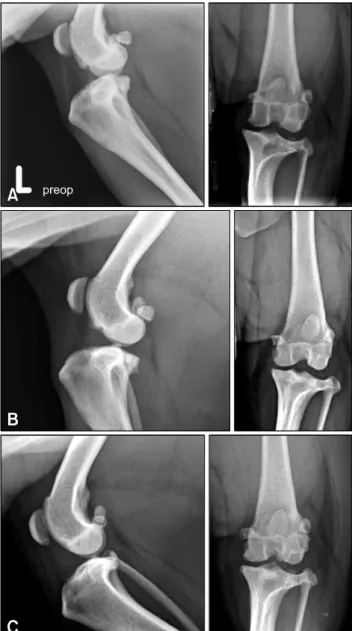 Fig. 4. Dog No. 4. Preoperative X-rays (A) evaluated signs of  OA, including the presence of osteophytes, effusion synovial,  and subchondral bone sclerosis