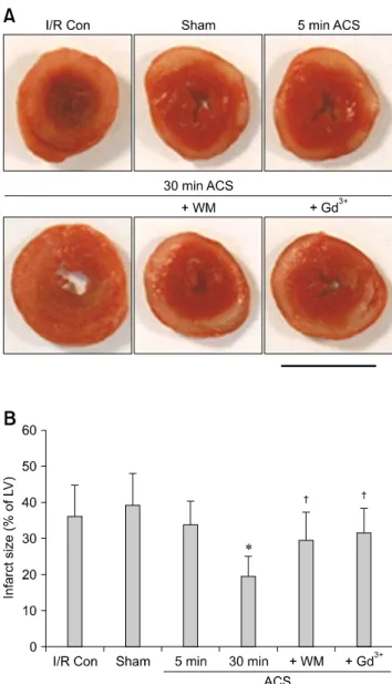 Fig. 4. Phosphorylation of Akt after ACS placement. After an  ACS was created in the rats, Akt phosphorylation was measured at different time points with wortmannin and Gd 3+  pretreatment