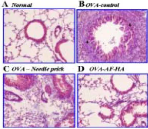 Fig. 6. Histological  analysis  of  lung  sections  from  mice 
