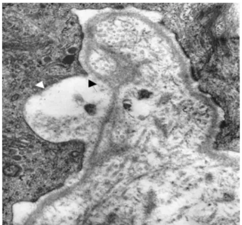 Fig. 4. Schematic representation of partial separation of epidermis (arrow) and dermis (arrowhead) by vacuum.