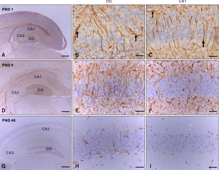 Fig. 2. Nestin immunostaining at PND 1 (A, B, C), 6 (D, E, F), and 48 (G, H , I) in the dentate gyrus (DG) and cornu ammonis (CA) 1 of mouse hippocampus