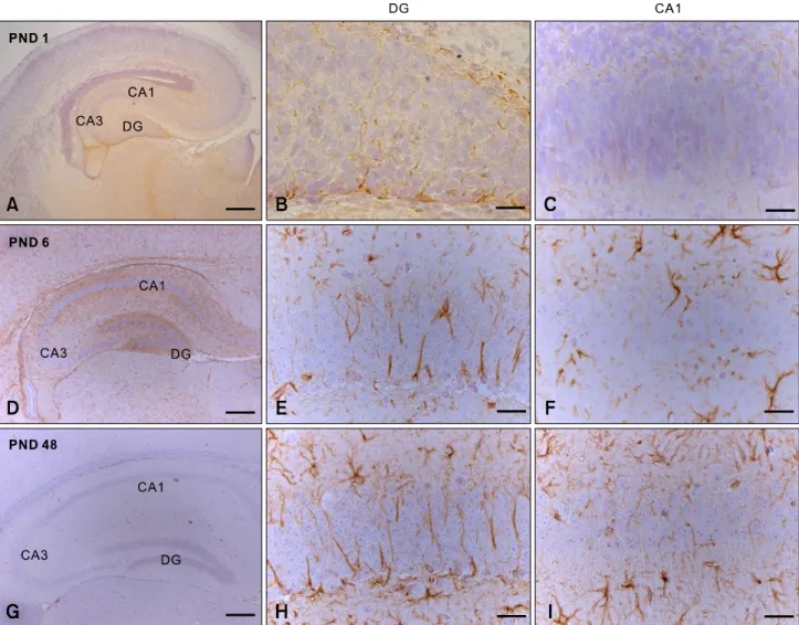 Fig. 3. GFAP immunostaining at PND 1 (A, B, C), 6 (D, E, F) and 48 (G, H, I) in the DG and CA1 of mouse hippocampus