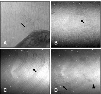 Table 2. Visualization of fetal bony structures at embryonic day  using synchrotron, mammography, and conventional radiography