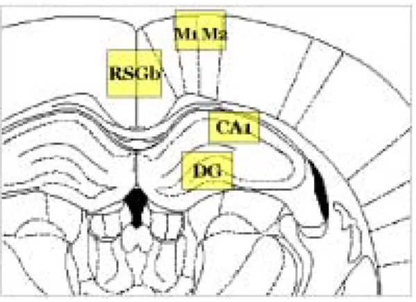 Fig. 1. Schematic  drawing  to  show  the  areas  analyzed  in  rat  brain  following  trasient  forebrain  ischemia