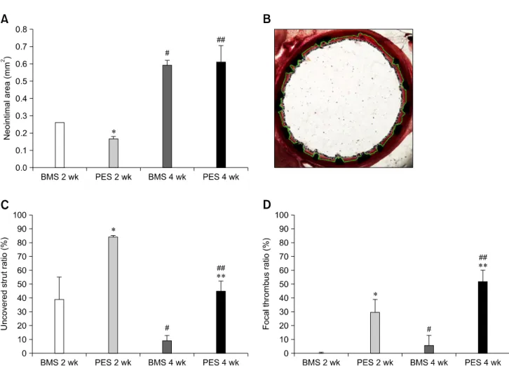 Fig. 3. Histomorphometric results of BMS or PES implantation. (A) Neointimal area. (B) Representation of neointimal area, media area (green line) and inner luminal area (square line)