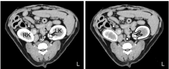 Fig. 1. Dynamic CT images centered in the left renal hilum  obtained at maximal aortic enhancement with iohexol