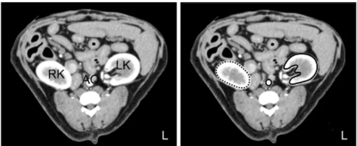 Fig. 1. Dynamic CT images centered in the left renal hilum  obtained at maximal aortic enhancement with iohexol