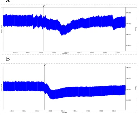 Fig. 1. A  typical  recording  of  lowered  blood  pressure  under  the  LR3  acupuncture in rats