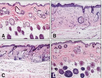Table 3. Changes in number of leukocytes at 4 week after various application following atopic dermatitis induction
