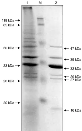 Fig. 1. SDS-PAGE of outer membrane preparation. Lane M  represents protein molecular weight marker