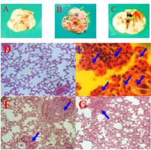 Fig. 2. Effects  of  SAL-HAS(Herbal-acupuncture  with  Sinomenii  acuti  Lignum  Infusion  Solution)  on  melanotic  colony  formation  of  pulmonary  tissue,  and  pulmonary  colony  number  of  C57BL/6  mice  implanted  intravenously  with  B16-F10  mela