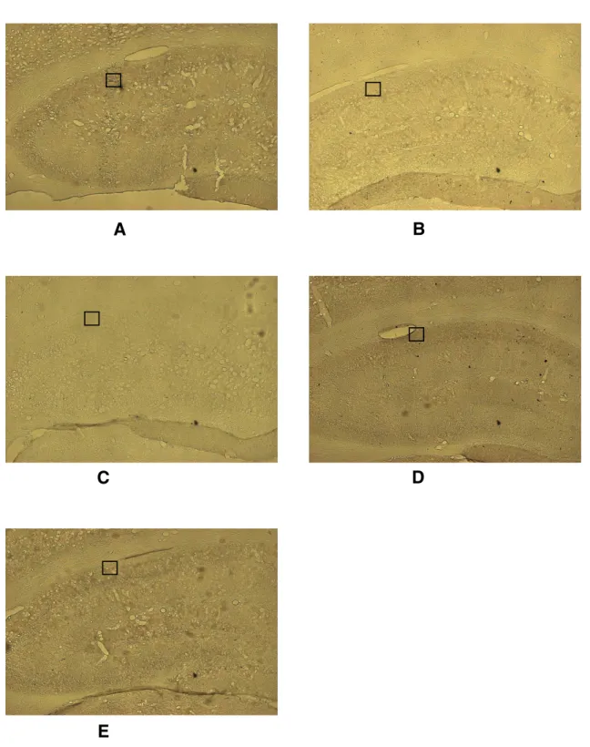 Fig. 9 Representive microphotographs of coronal sections in the hippocampal CA1. As compared with density of B,C group, that of The density of D group was increased(P<0.05) A:Sham, B:Control, C:SAL, D:BCL1, E:BCL2