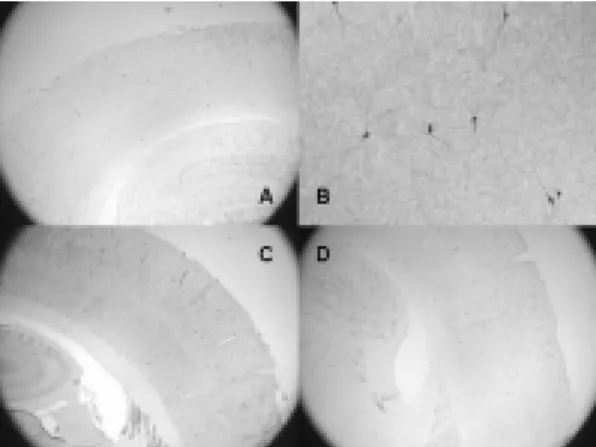 Fig. 2. Effects  of  FOLIUM  ARTEMISIAE  ARGYI'  herbal  acupuncture  of  acupoint  LR3  on  nNOS  protein  expression  in  the  motor  cortex  at  2  hrs  after  transient  forebrain  ischemia