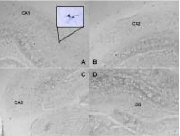 Fig. 4. Effects  of  FOLIUM  ARTEMISIAE  ARGYI'  herbal  acupuncture  of  acupoint  LR3  on  nNOS  protein  expression  in  the  hippocampus  at  2  hrs  after  transient  forebrain  ischemia