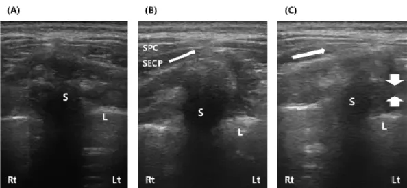 Fig.  4.  Transverse  scan  image  of  cervical  spine  on  single  subject,  neutral  position,  45  degree  rotation  and  full  range  of  motion  rotation