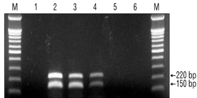 Fig. 1. Sensitivity of the duplex RT-PCR detecting PERV gag RNA and porcine GAPDH mRNA in PK-15 cell