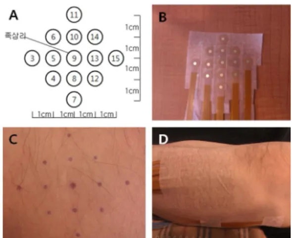 Fig. 1. Measuring points at ST36 and electrode array.