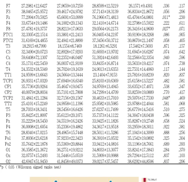 Fig. 3. Topographical display of EEG activity within β range due to PC7 acupuncture treatment
