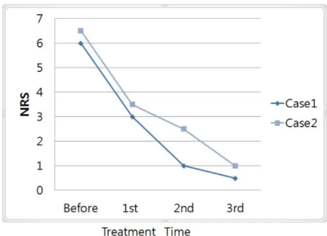 Table III. The Change of ROM before and after TreatmentFig. 14. Structure of tensegrity12).