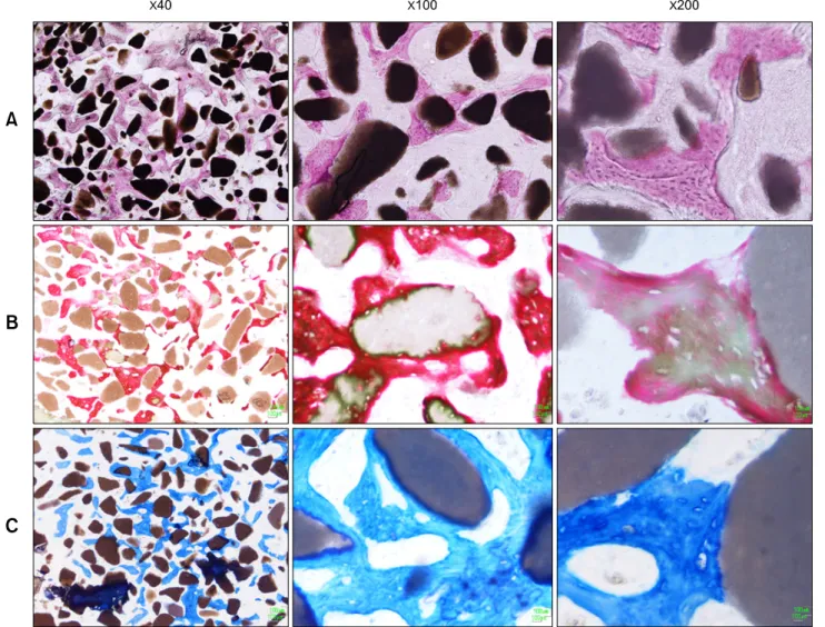 Fig. 3. Microphotographs of longitudinal sections of implants in  the groups C (A) and CM (B, C) at 12 weeks after implantation of β-TCP