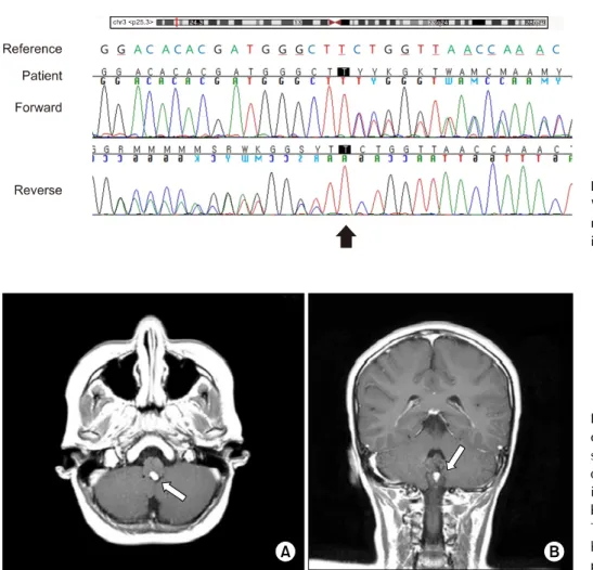 Fig.  3.  Sequence  analysis  of  the  VHL gene. A heterozygous novel  va-riant of c.384dup (p.Leu129Serfs*3) in  exon  2  is  noted.