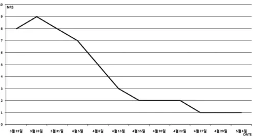 Fig. 7. NDI variations.