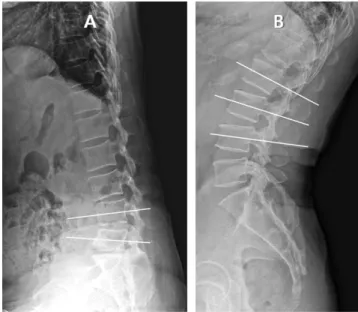 Fig. 1. Flexion and Extension Malposition.