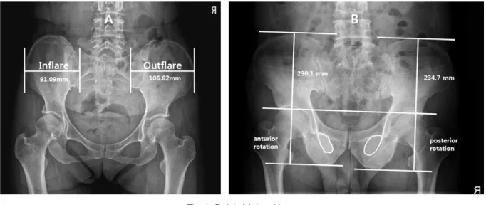 Fig. 6. Pelvic Malpositions.