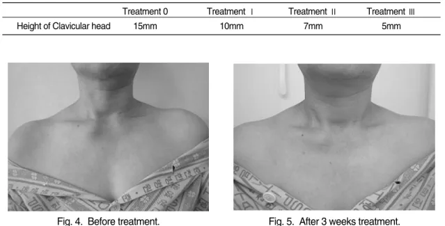 Fig. 3.  The change of VAS.