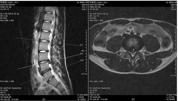 Fig. 8.  T2-weighted image of case 3 before treatment.