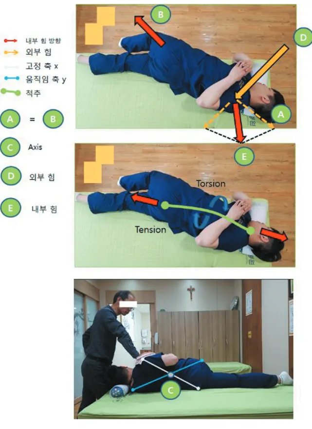Fig. 4. 선우정골요법에 사용된 힘과 벡터에 도해.
