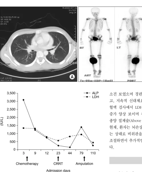Fig. 3. Chest CT (A) and bone scan (B) reveal that no metastasis is  noted.