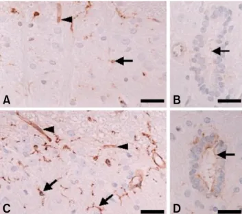 Fig. 1. Western blot analysis for p-caveolin-1 (A), ED1 (B), fi- fi-bronectin (C) in the spinal cords of the normal control rats  (Normal controls) and irradiated rats at day 1 post-irradiation  (Irradiation)