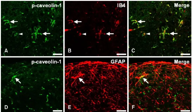 Fig. 3. Identification of p-caveolin-1-positive cells in the spinal cord of the irradiated rats at 24 h post-irradiation