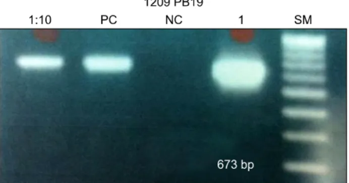 Fig. 1. Polymerase chain reaction of the patient serum using the parvovirus B19-specific primers shows the band (size 673 bp) on the 4th panel
