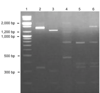 Table 2. Comparison of the nucleotide and deduced amino acid sequences of the S1 glycoprotein gene of 12 Korean IBV isolates and non-Korean strains