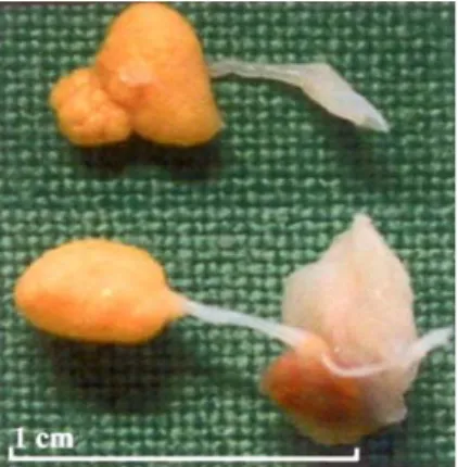 Fig. 1.  Macroscopic picture of the rice bodies. The shape and size of those structures vary slightly but both are pedunculated, attached by a thin white strand and composed of a nodular yellow tinted body.