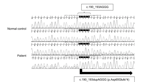Fig. 2. Direct sequencing analysis of the GATA1 gene. Mutation, c.190_193dupAGGG (p.Asp65Gluf*4), is identified in the N-terminal activation domain of GATA1 exon 2.