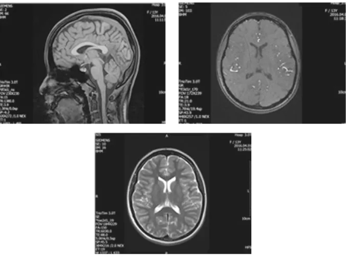 Fig. 1. Brain MRI image(No medical problems).