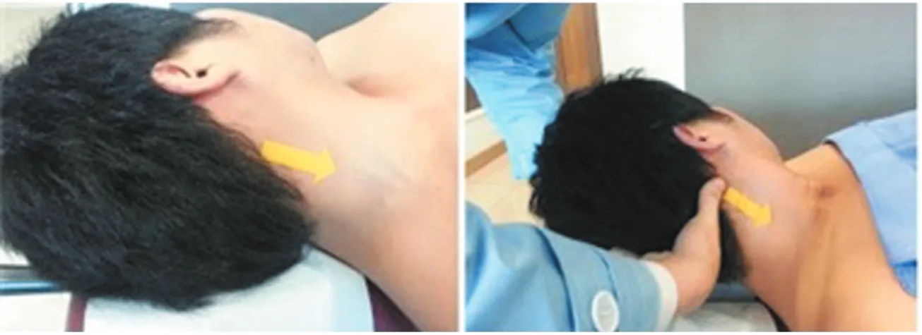 Fig. 3. Myofascial Release Technique on cervical fascia.